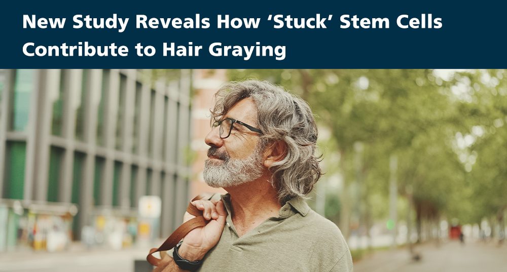 New Study Reveals How ‘Stuck’ Stem Cells Contribute to Hair Graying