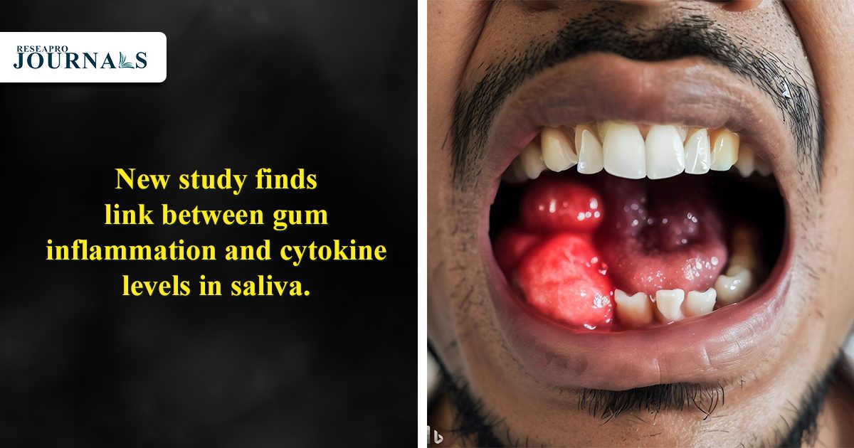 New study finds link between gum inflammation and cytokine levels in saliva.