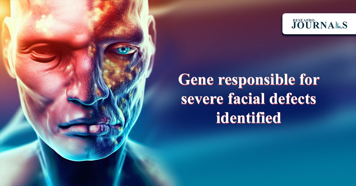 Gene responsible for severe facial defects identified