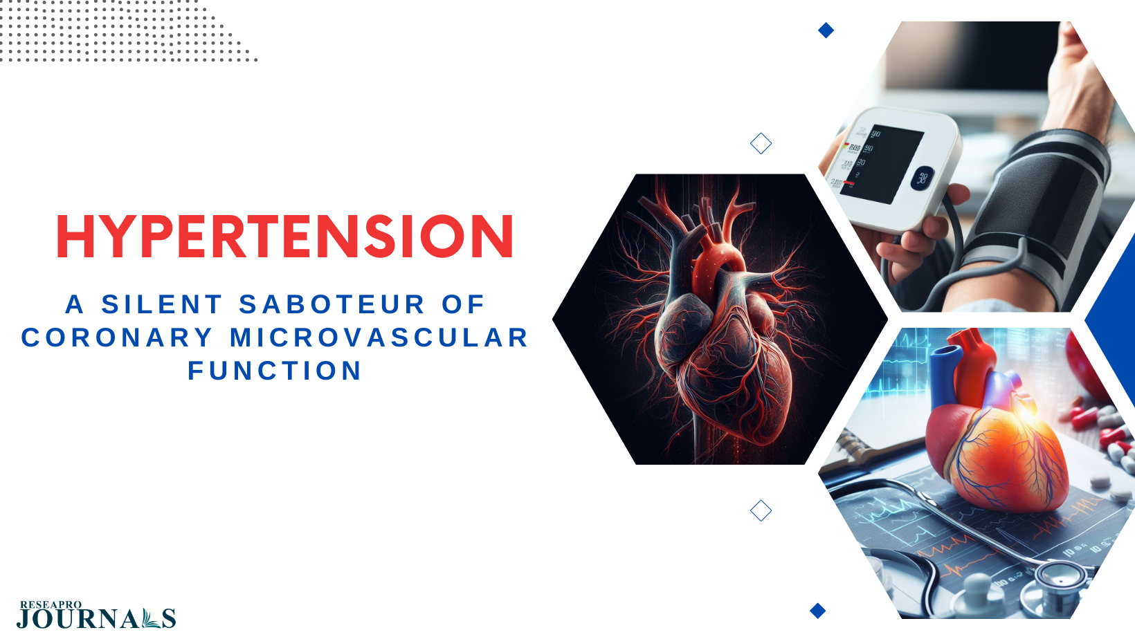 Hypertension: A silent saboteur of coronary microvascular function
