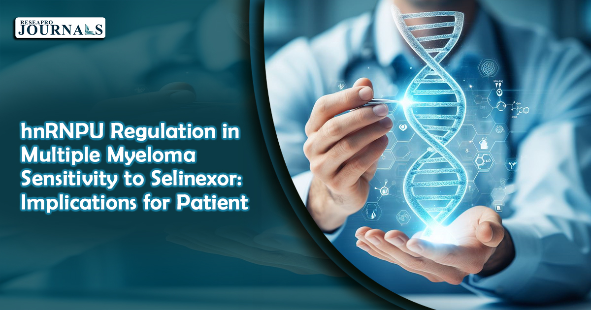 hnRNPU Regulation in Multiple Myeloma Sensitivity to Selinexor: Implications for Patient Stratification