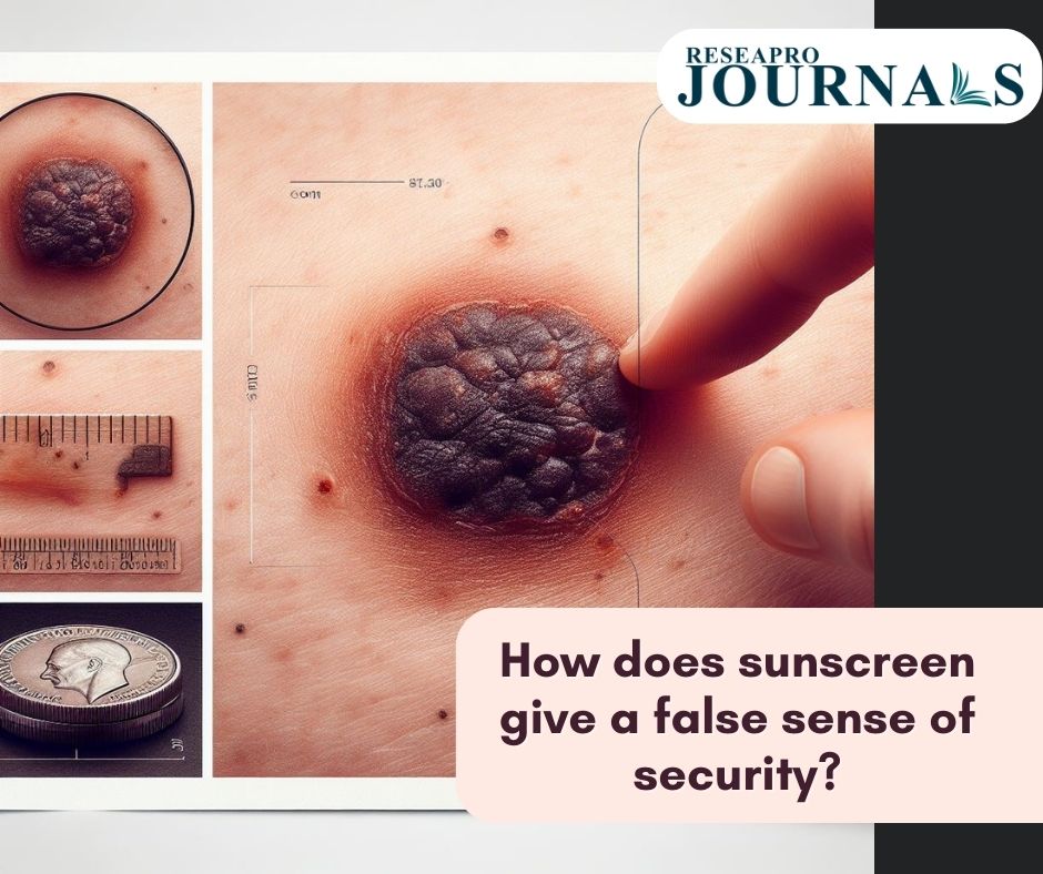 Don’t let sunscreen substitute sun-smart habits; protect your skin wisely.