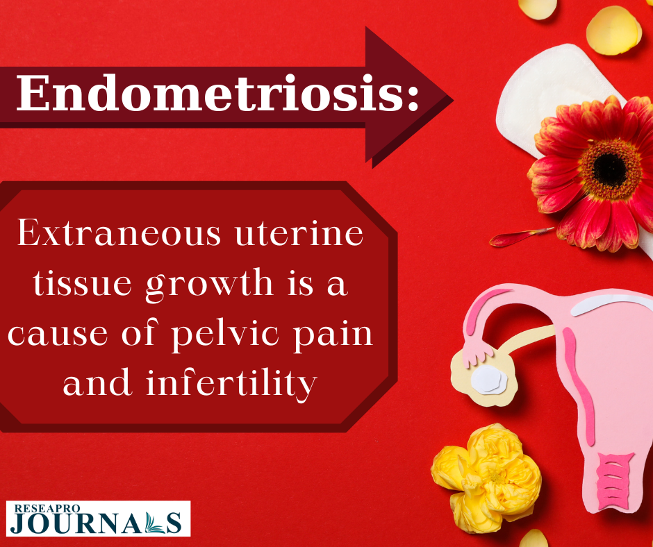 Unveiling Endometriosis: Navigating pain, fertility hurdles, and awareness