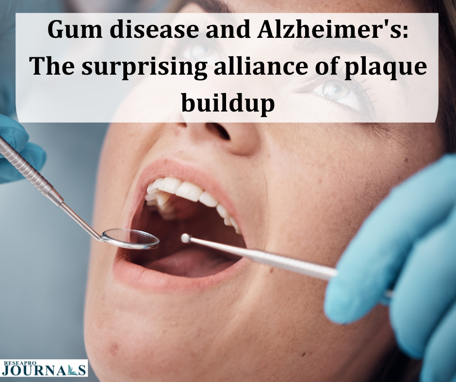 Gum disease and Alzheimer’s: The surprising alliance of plaque buildup