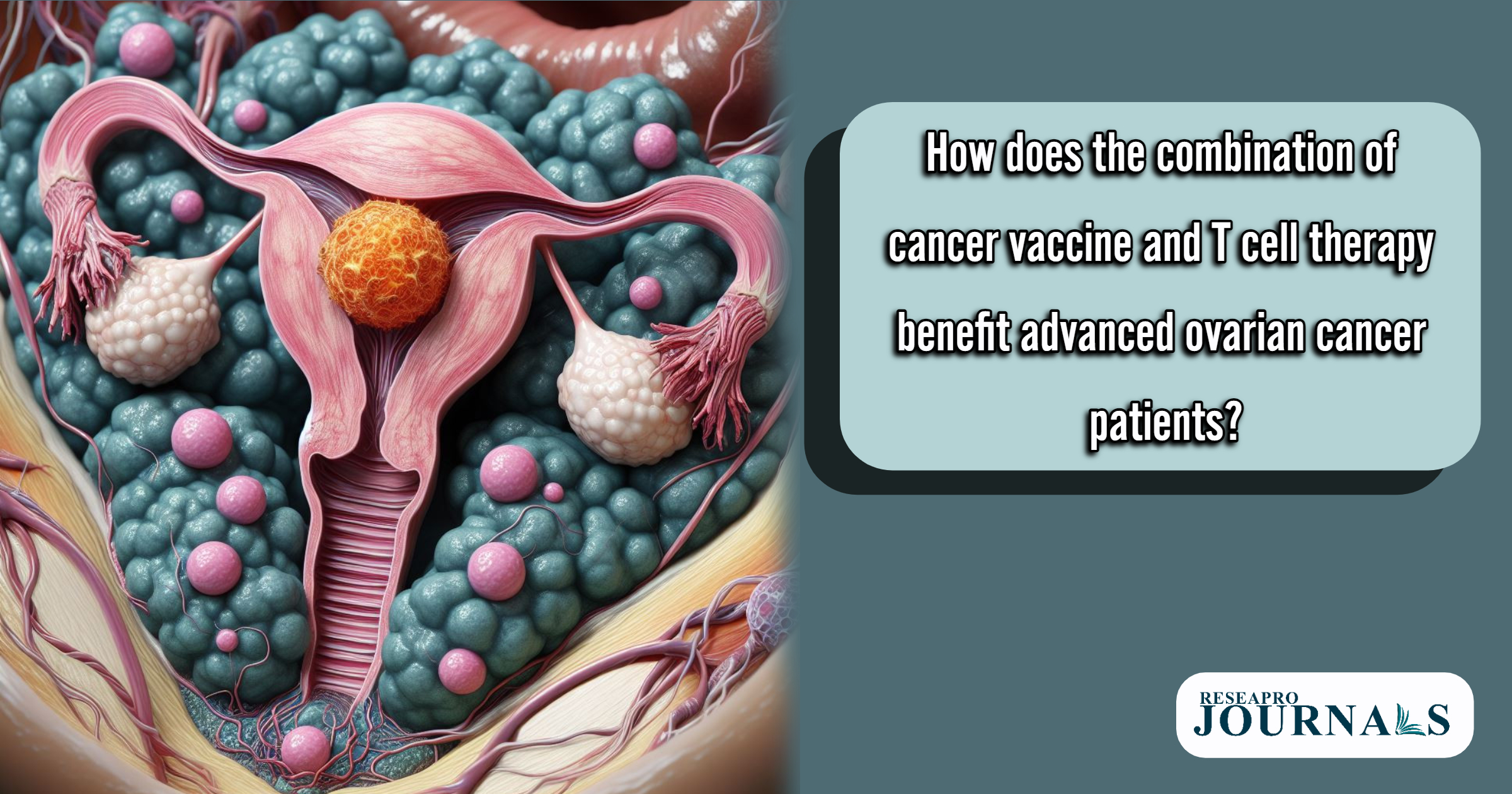 Revolutionizing ovarian cancer treatment: Immunotherapy’s promising combo for patients.