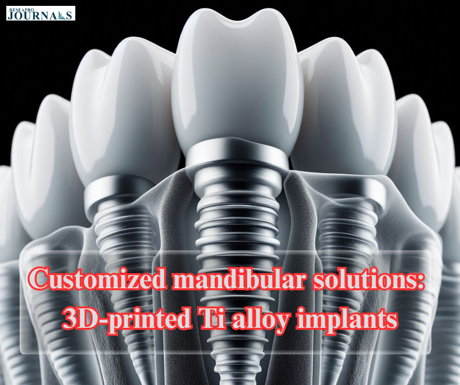 Customized mandibular solutions: 3D-printed Ti alloy implants